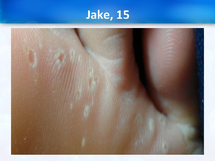 Jake, 15 