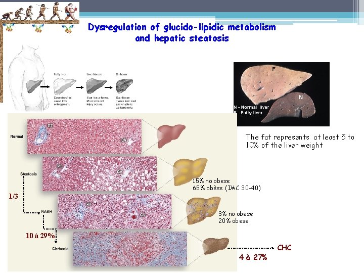 Dysregulation of glucido-lipidic metabolism and hepatic steatosis The fat represents at least 5 to