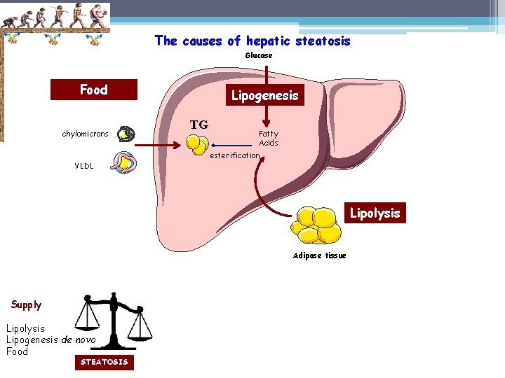 The causes of hepatic steatosis Glucose Food chylomicrons VLDL Lipogenesis TG Fatty Acids esterification