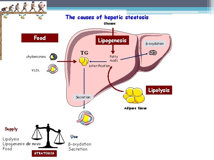 The causes of hepatic steatosis Glucose Food Lipogenesis TG chylomicrons -oxydation Fatty Acids esterification