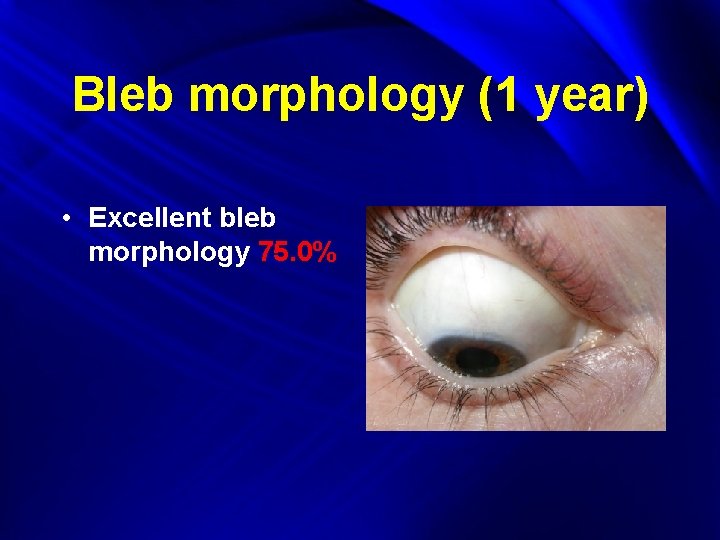 Bleb morphology (1 year) • Excellent bleb morphology 75. 0% 