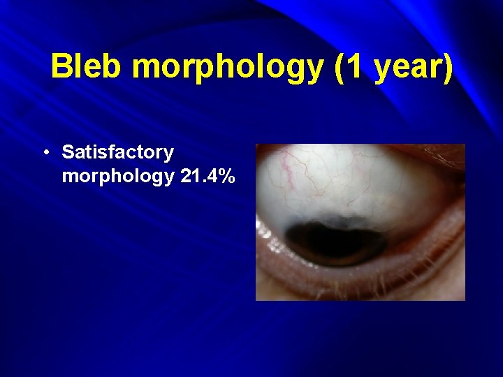 Bleb morphology (1 year) • Satisfactory morphology 21. 4% 
