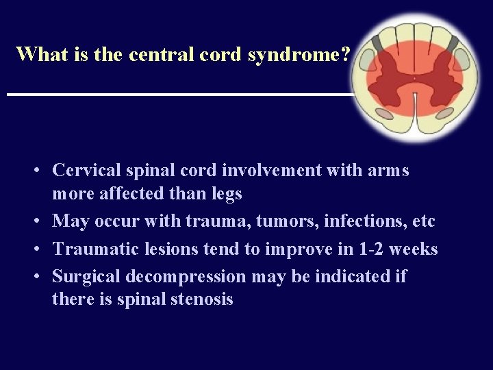 What is the central cord syndrome? • Cervical spinal cord involvement with arms more