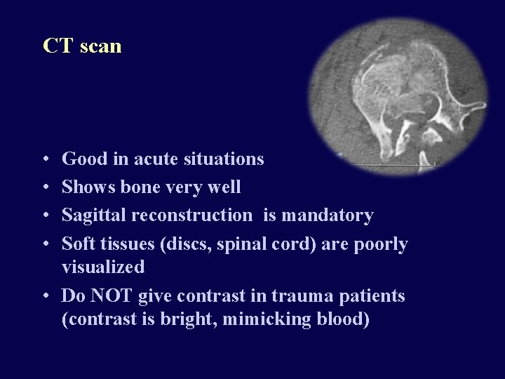CT scan • • Good in acute situations Shows bone very well Sagittal reconstruction