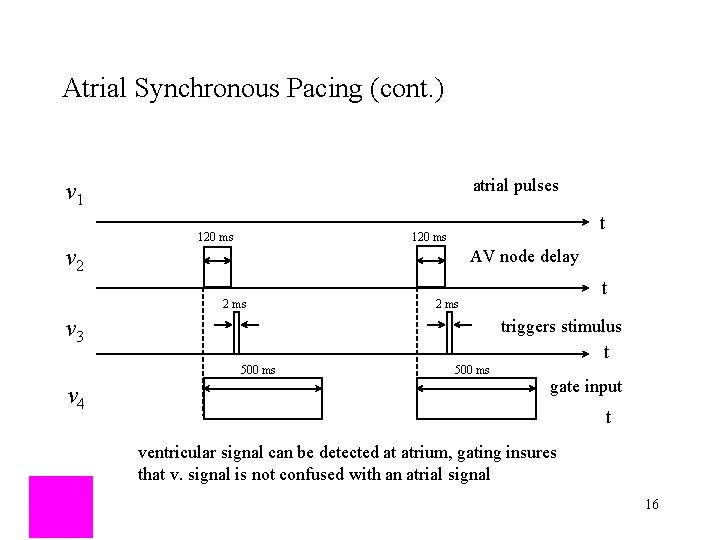 Atrial Synchronous Pacing (cont. ) atrial pulses v 1 v 2 t 120 ms