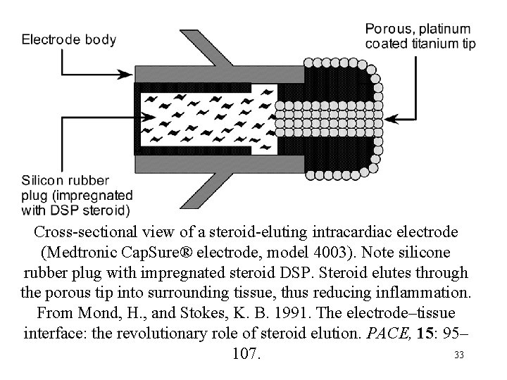  Cross-sectional view of a steroid-eluting intracardiac electrode (Medtronic Cap. Sure® electrode, model 4003).