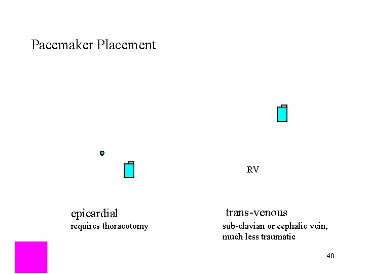 Pacemaker Placement RV epicardial requires thoracotomy trans-venous sub-clavian or cephalic vein, much less traumatic