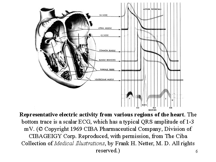 Representative electric activity from various regions of the heart. The bottom trace is a
