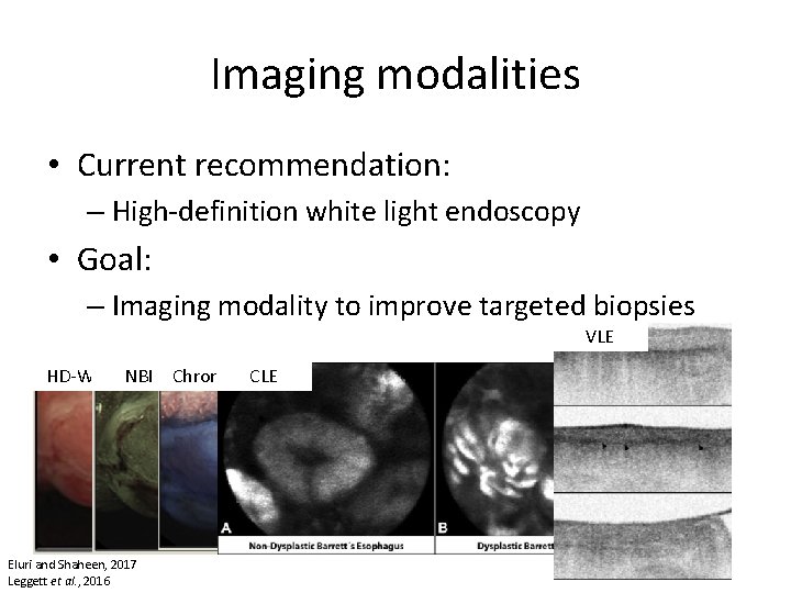 Imaging modalities • Current recommendation: – High-definition white light endoscopy • Goal: – Imaging