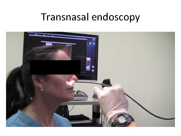 Transnasal endoscopy 