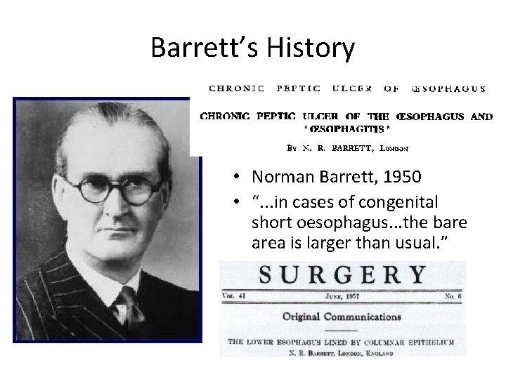 Barrett’s History • Norman Barrett, 1950 • “. . . in cases of congenital