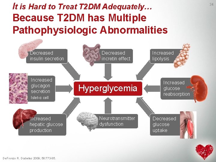It is Hard to Treat T 2 DM Adequately… 34 Because T 2 DM