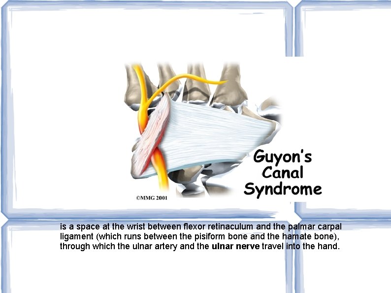 is a space at the wrist between flexor retinaculum and the palmar carpal ligament