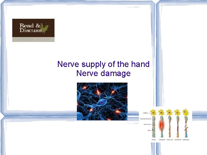Nerve supply of the hand Nerve damage 