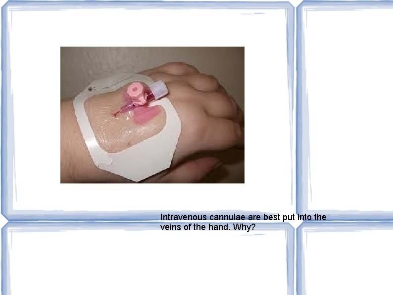 Intravenous cannulae are best put into the veins of the hand. Why? 