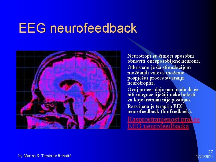 EEG neurofeedback Neurotropi su činioci sposobni obnoviti onesposobljene neurone. Otkriveno je da stimulacijom moždanih