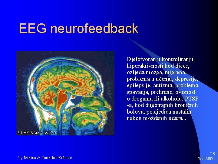 EEG neurofeedback Djelotvoran u kontroliranju hiperaktivnosti kod djece, ozljeda mozga, migrena, problema u učenju,