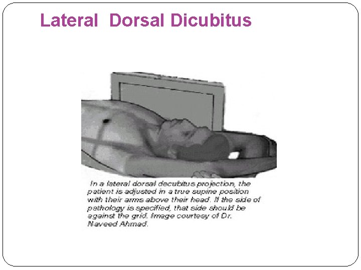 Lateral Dorsal Dicubitus 