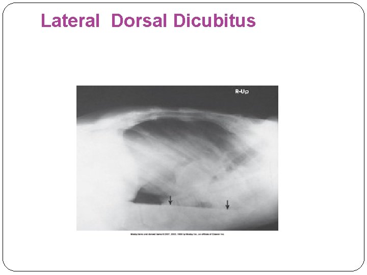 Lateral Dorsal Dicubitus 