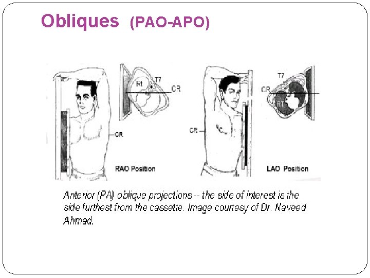 Obliques (PAO-APO) 