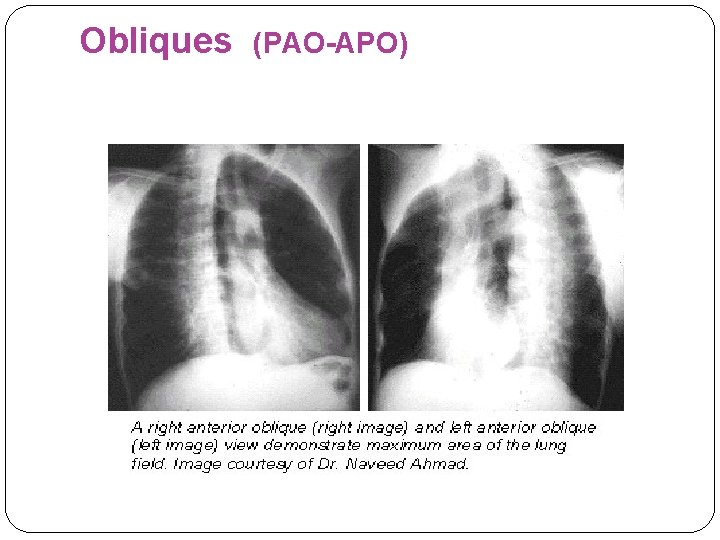 Obliques (PAO-APO) 