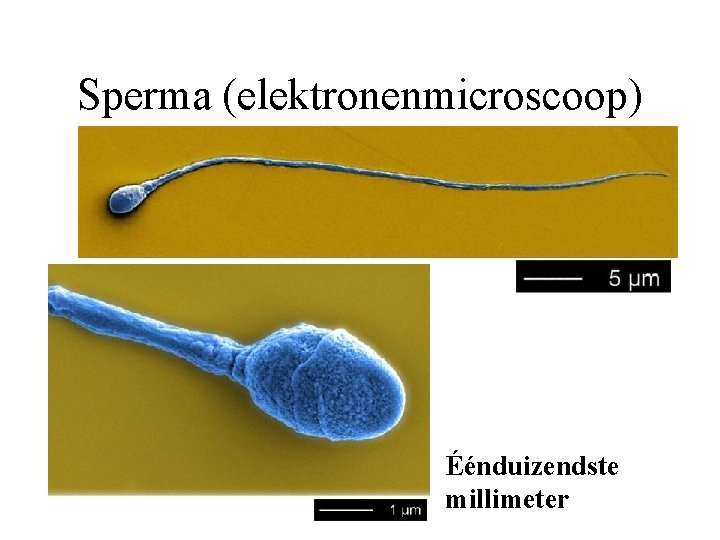 Sperma (elektronenmicroscoop) Éénduizendste millimeter 