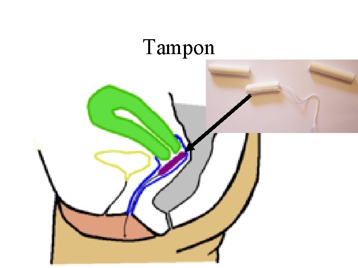 Tampon 