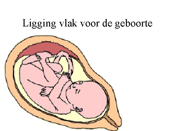 Ligging vlak voor de geboorte 