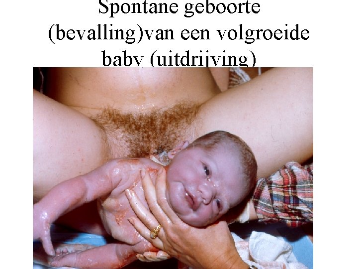 Spontane geboorte (bevalling)van een volgroeide baby (uitdrijving) 