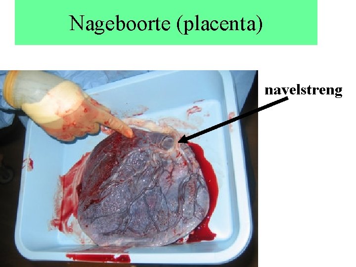 Nageboorte (placenta) navelstreng 