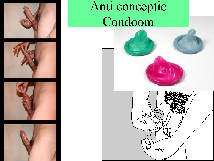 Anti conceptie Condoom 