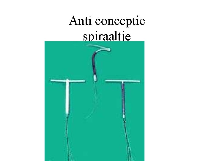 Anti conceptie spiraaltje 