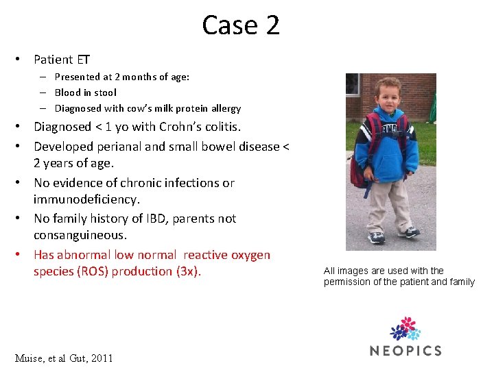 Case 2 • Patient ET – Presented at 2 months of age: – Blood