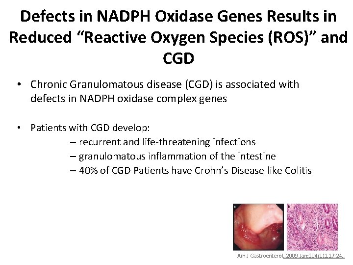 Defects in NADPH Oxidase Genes Results in Reduced “Reactive Oxygen Species (ROS)” and CGD