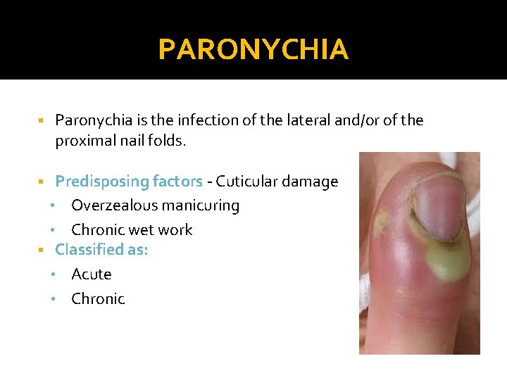 PARONYCHIA § Paronychia is the infection of the lateral and/or of the proximal nail