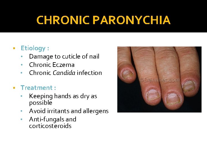 CHRONIC PARONYCHIA § Etiology : • Damage to cuticle of nail • Chronic Eczema