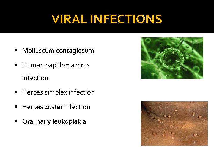 VIRAL INFECTIONS § Molluscum contagiosum § Human papilloma virus infection § Herpes simplex infection
