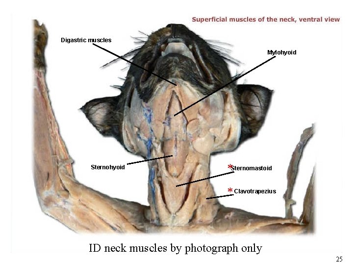 Digastric muscles Mylohyoid Sternohyoid *Sternomastoid * Clavotrapezius ID neck muscles by photograph only 25