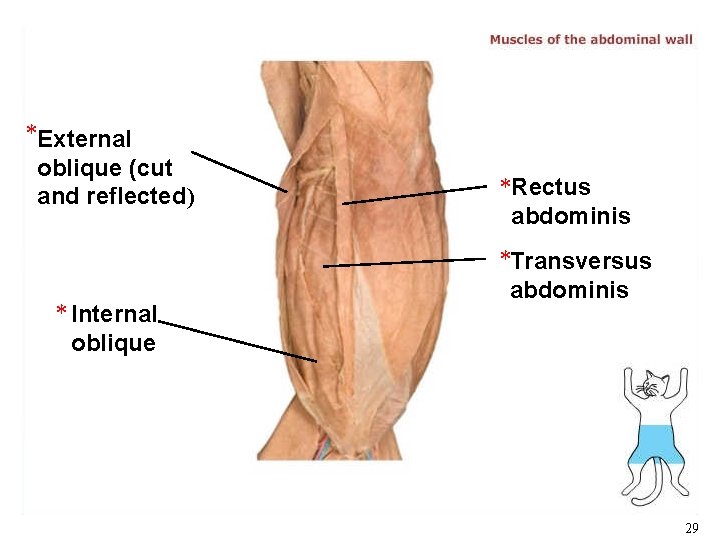 *External oblique (cut and reflected) * Internal oblique *Rectus abdominis *Transversus abdominis 29 *External oblique (cut and reflected) * Internal oblique *Rectus abdominis *Transversus abdominis 29