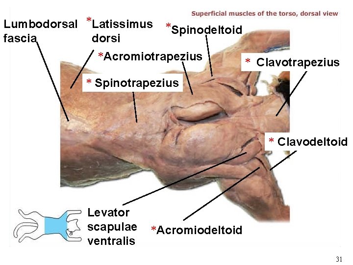 Lumbodorsal *Latissimus fascia dorsi *Spinodeltoid *Acromiotrapezius * Clavotrapezius * Spinotrapezius * Clavodeltoid Levator scapulae Lumbodorsal *Latissimus fascia dorsi *Spinodeltoid *Acromiotrapezius * Clavotrapezius * Spinotrapezius * Clavodeltoid Levator scapulae