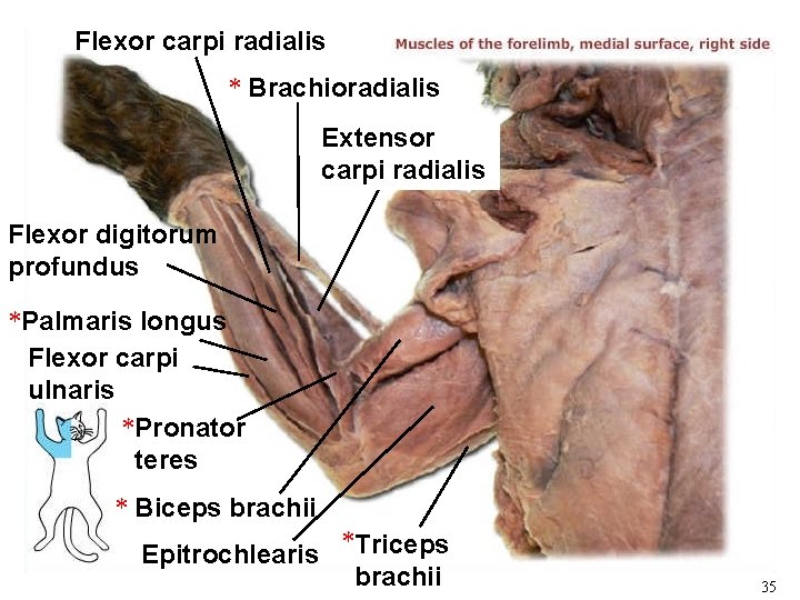 Flexor carpi radialis * Brachioradialis Extensor carpi radialis Flexor digitorum profundus *Palmaris longus Flexor