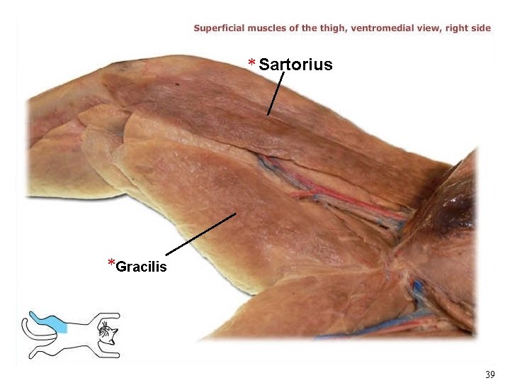 * Sartorius *Gracilis 39 * Sartorius *Gracilis 39