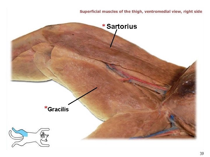 * Sartorius *Gracilis 39 