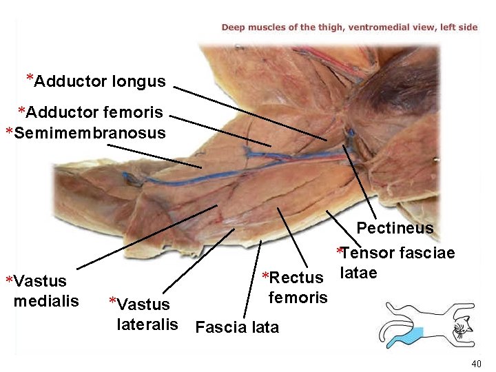 *Adductor longus *Adductor femoris * Semimembranosus *Vastus medialis Pectineus *Tensor fasciae *Rectus latae femoris *Adductor longus *Adductor femoris * Semimembranosus *Vastus medialis Pectineus *Tensor fasciae *Rectus latae femoris