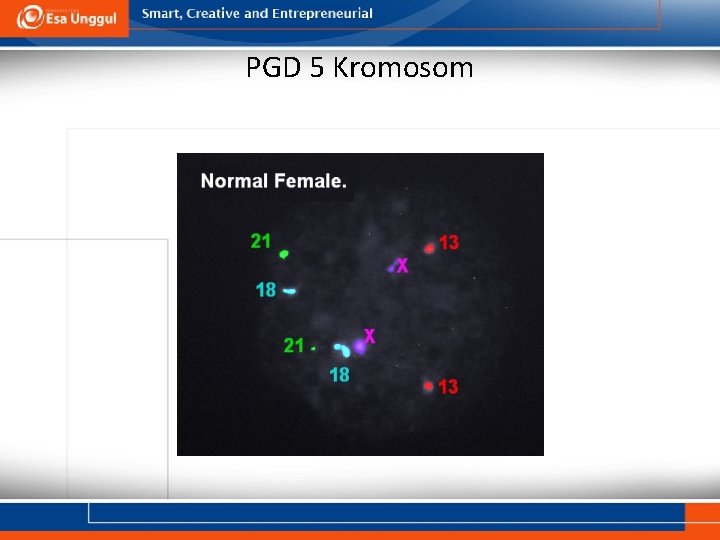 PGD 5 Kromosom 