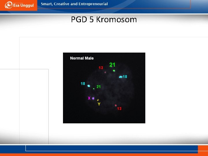 PGD 5 Kromosom 