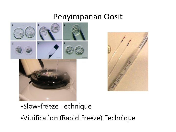 Penyimpanan Oosit • Slow-freeze Technique • Vitrification (Rapid Freeze) Technique 