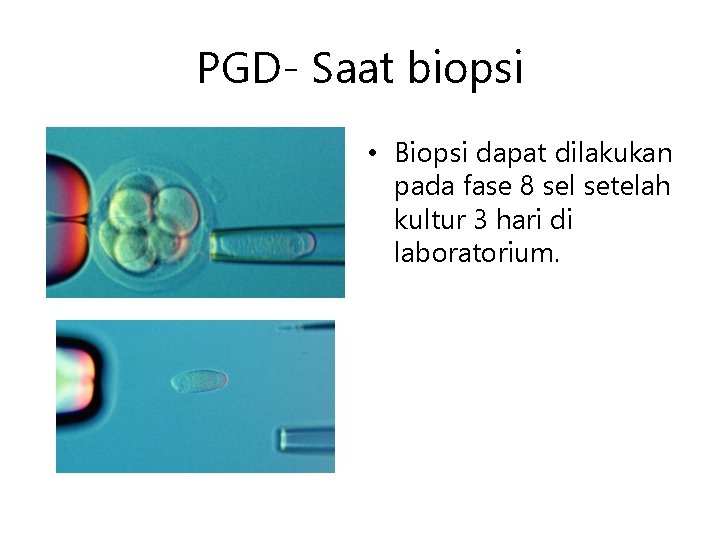 PGD- Saat biopsi • Biopsi dapat dilakukan pada fase 8 sel setelah kultur 3