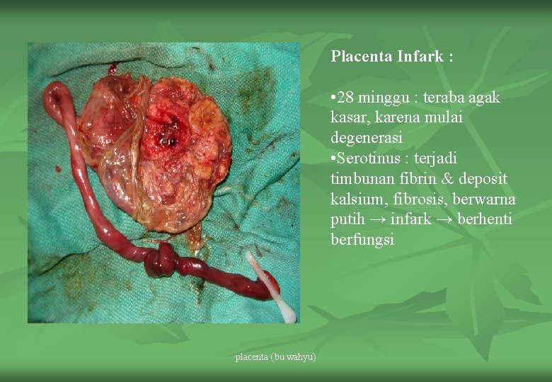 Placenta Infark : • 28 minggu : teraba agak kasar, karena mulai degenerasi •