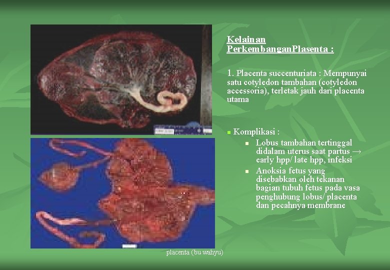 Kelainan Perkembangan. Plasenta : 1. Placenta succenturiata : Mempunyai satu cotyledon tambahan (cotyledon accessoria),